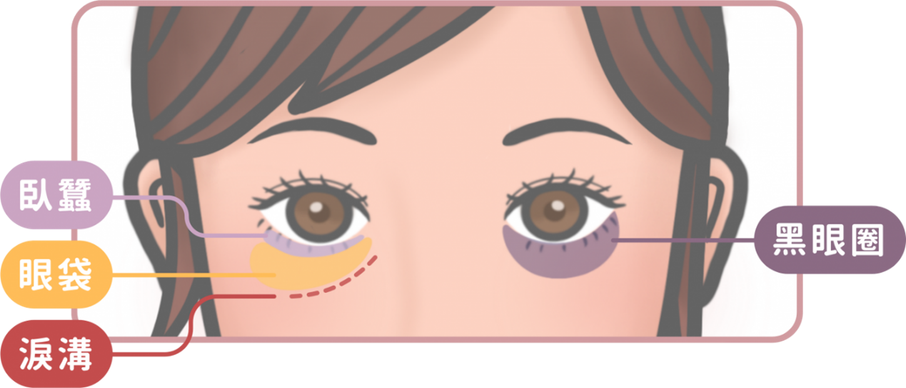 淚溝與黑眼圈結構
