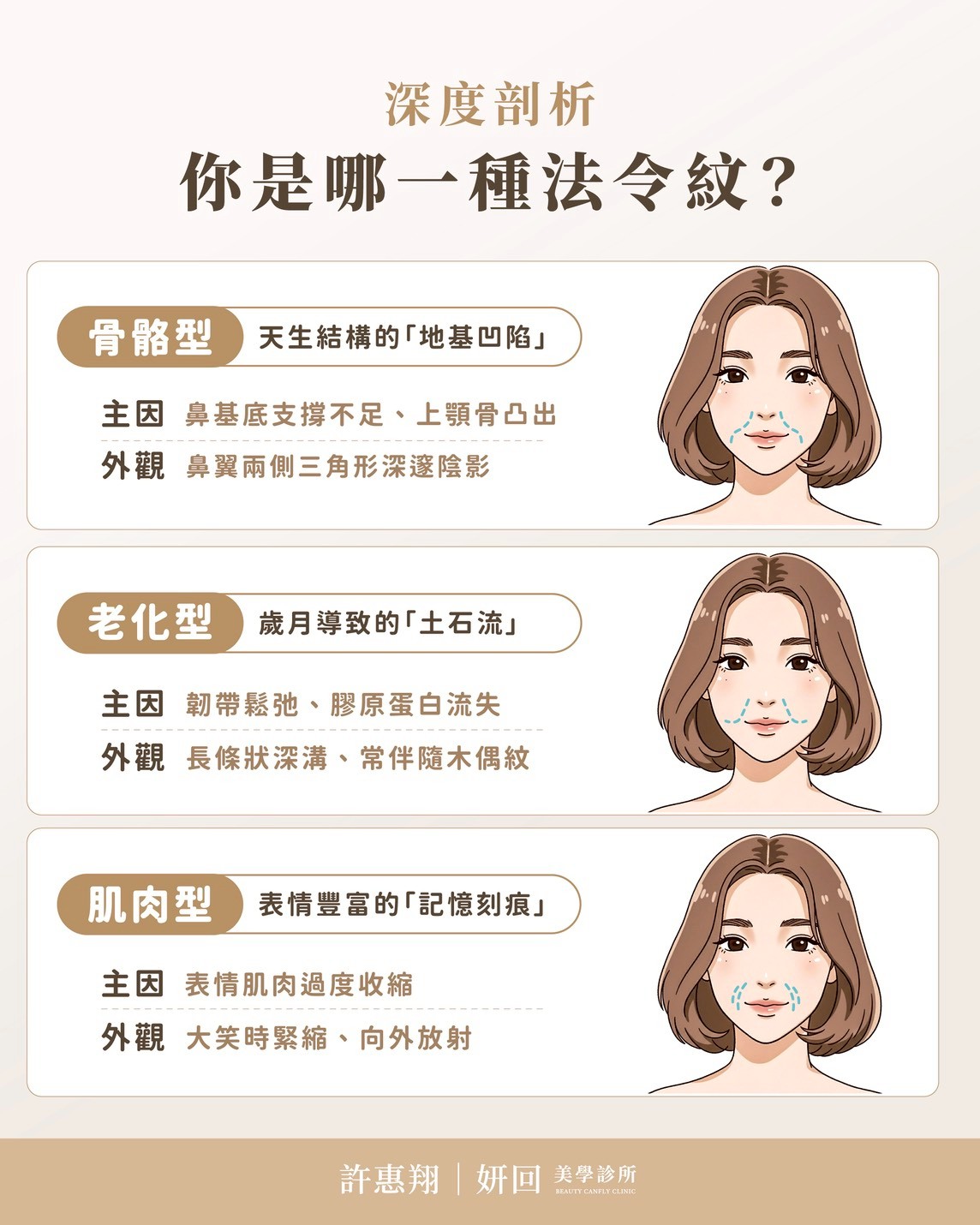 法令紋三大類型分析